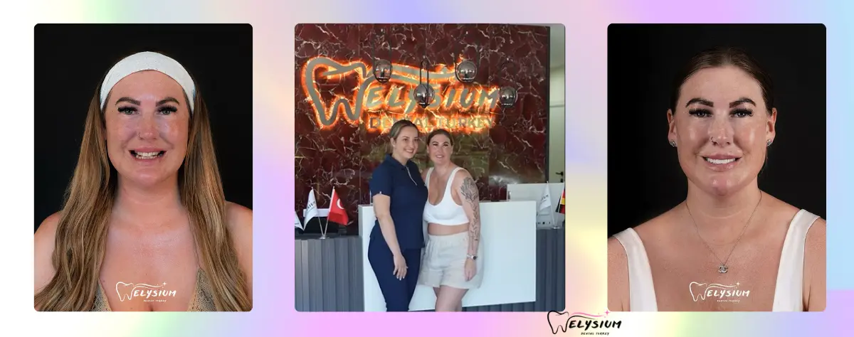 Personalized Dental Approach Antalya Turkey Personalized Dental Approach Antalya Turkey