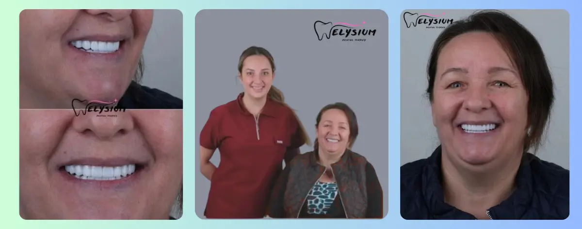 Private Dental Treatment Price List Antalya Turkey Private Dental Treatment Price List Antalya Turkey
