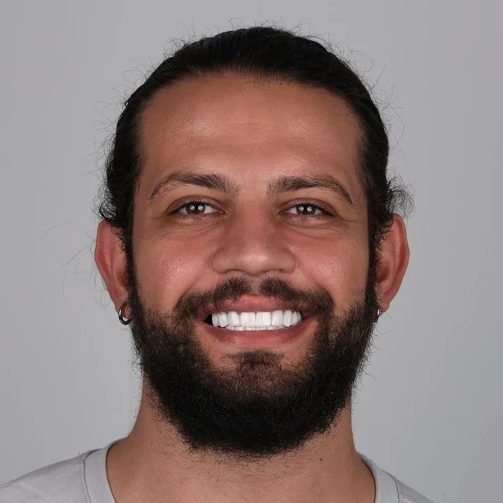 Smile Gallery-Before and After Photos