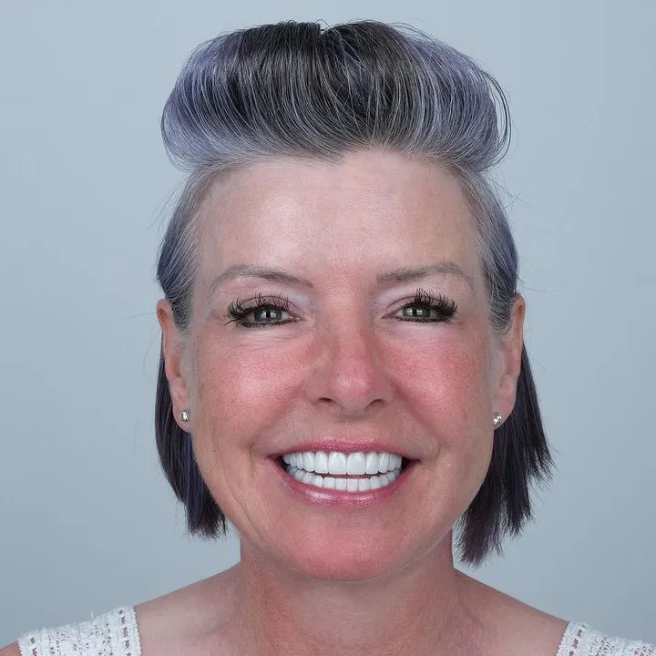 Smile Gallery-Before and After Photos