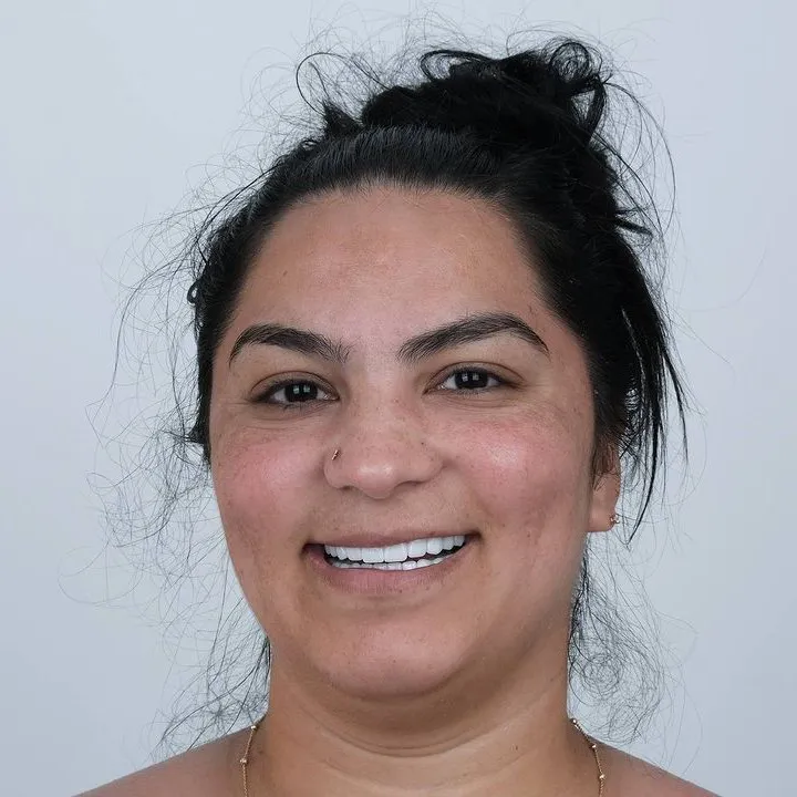 Smile Gallery-Before and After Photos