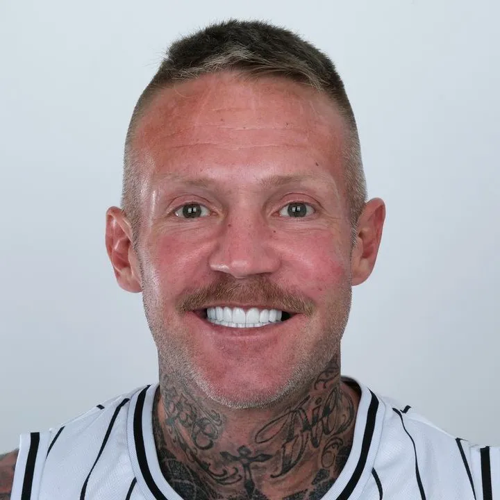 Smile Gallery-Before and After Photos