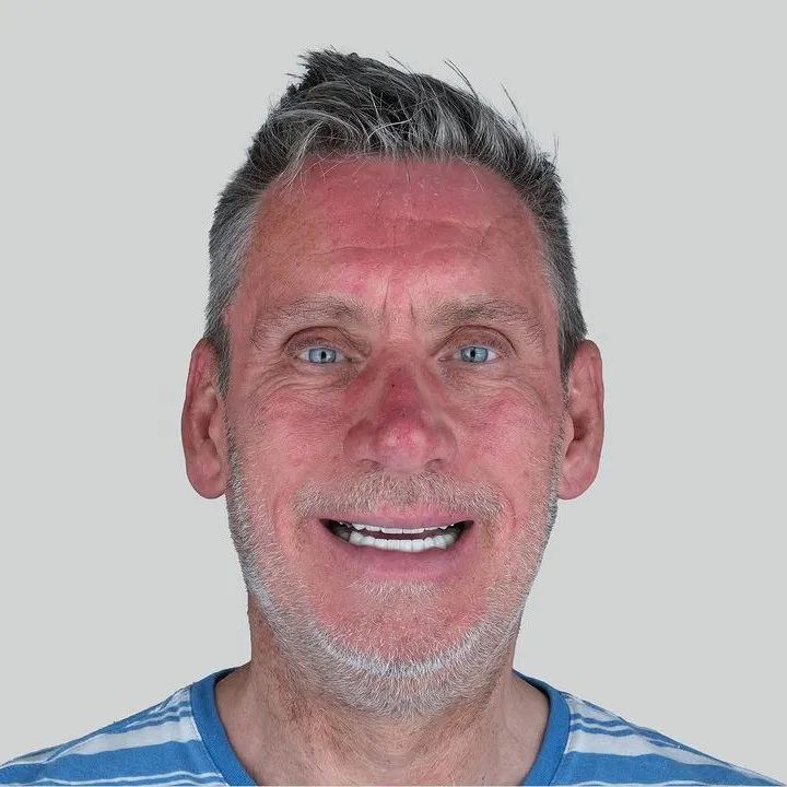 Smile Gallery-Before and After Photos