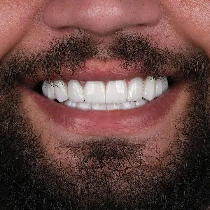 Smile Gallery-Before and After Photos