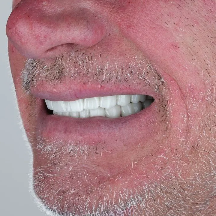Smile Gallery-Before and After Photos