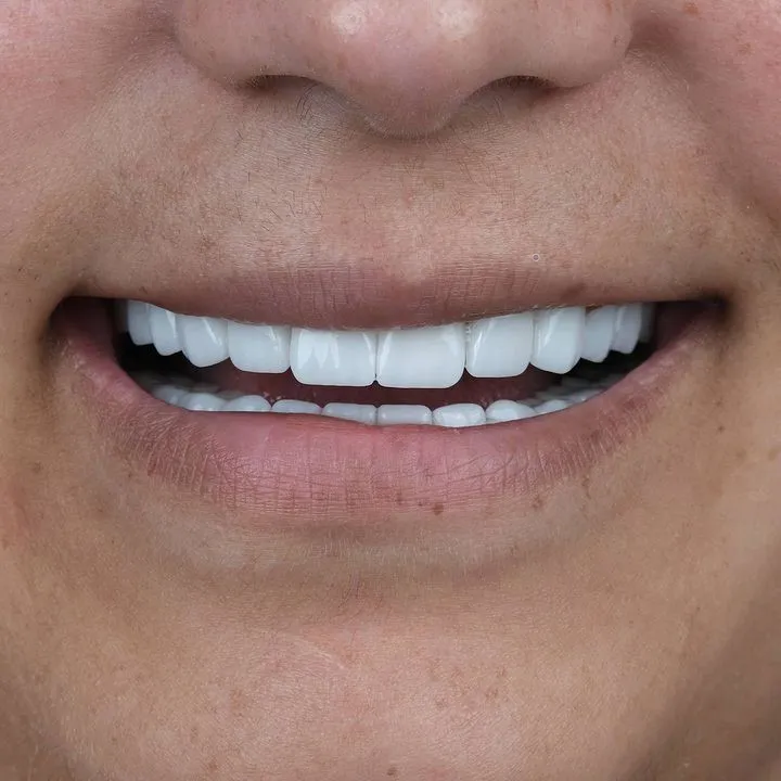Smile Gallery-Before and After Photos